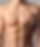 Gynecomastia