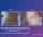 Abdominal And Sides Liposuction - before (left) and after (right) result