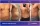 Abdominal And Sides Liposuction - before (left) and after (right) result