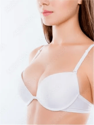 Breast implants
