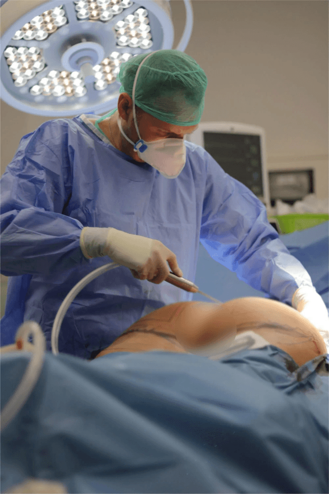 Dr boliglowa bbl